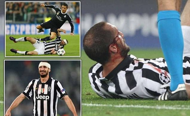 Chiellini Kawal Ketat Striker Real Madrid Meski Kepalany Diperban